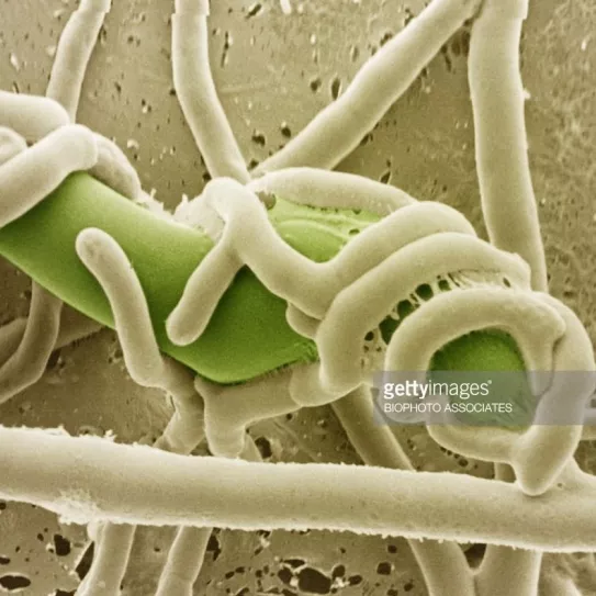 Soy partidaria del cultivo ecológico y quiero saber más sobre el uso de Trichoderma. ¿Cómo se utiliza?, ¿qué ventajas tiene?, ¿es verdad que se puede reproducir en casa?