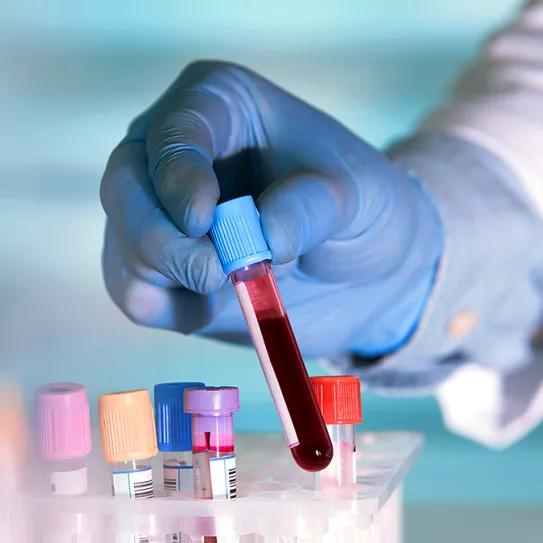 THC permanece en sangre bastante tiempo después de su consumo