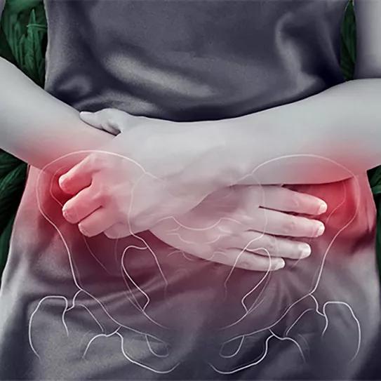 El cannabis también sirve a las pacientes con dolor pélvico crónico