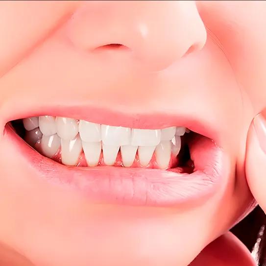 De seguro viste este movimiento mandibular en alguna fiesta