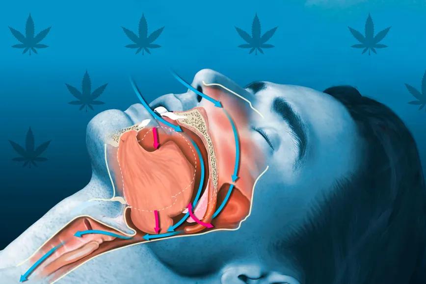 Cannabis mejora el sueño en pacientes con apnea