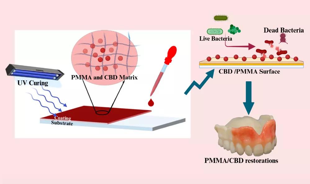 Antimicrobial Denture Material Synthesized from Poly(methyl methacrylate) Enriched with Cannabidiol Isolates