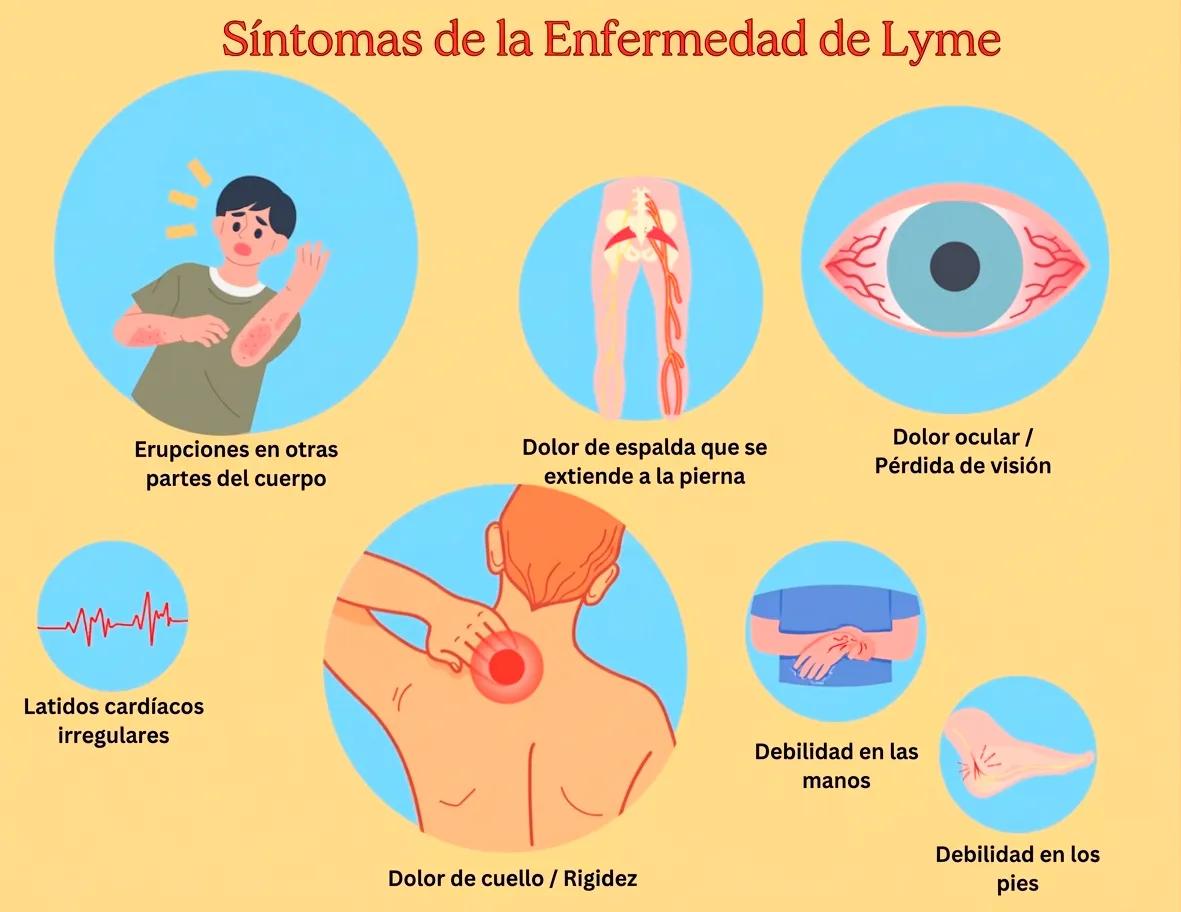 Psilocibina para enfrentar los efectos persistentes de la enfermedad de Lyme